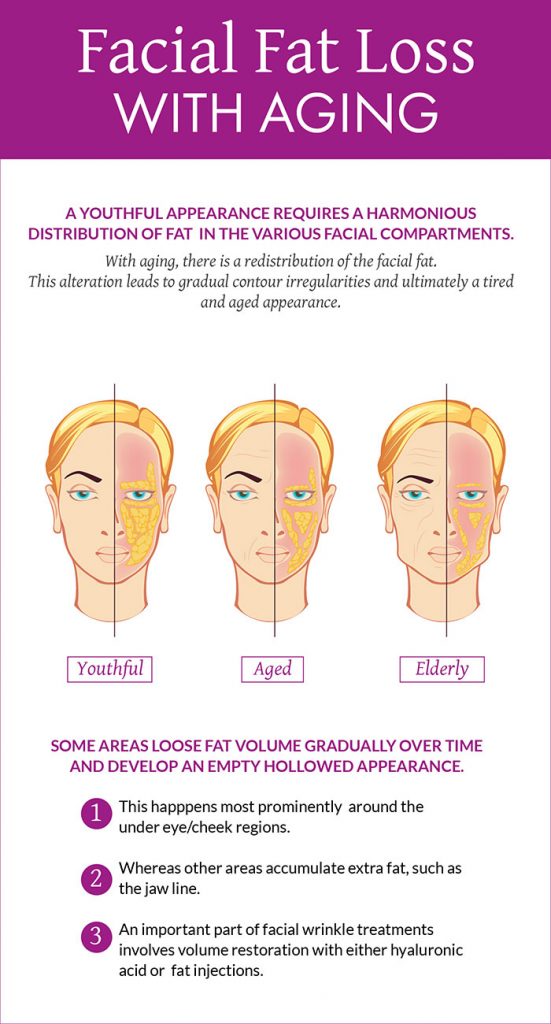 Facial Fat Transfer Hamburg Dr. Dalia Tobbia