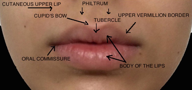 Lippenaufspritzung